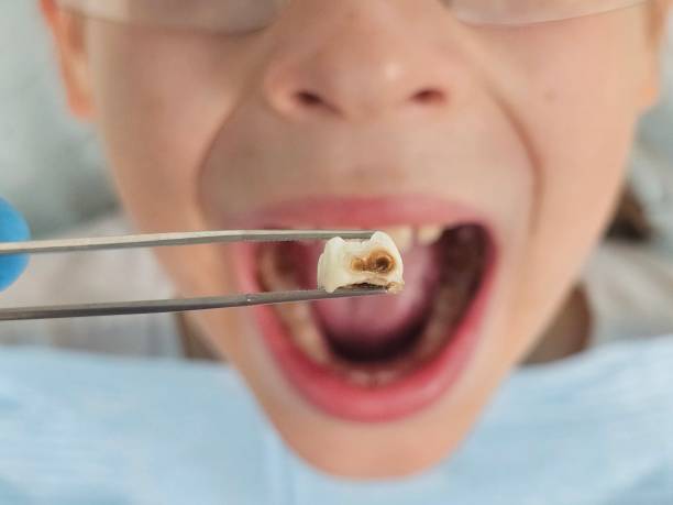 Emergency Dentist Open Today in NE