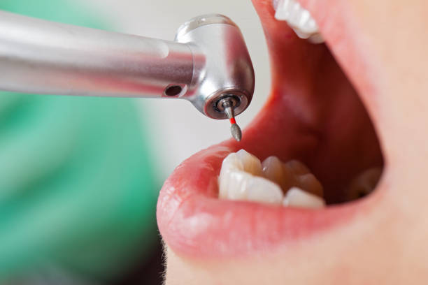 Dentist for Dental Trauma in NE